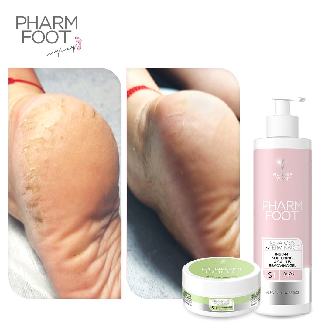 PHARM FOOT Komplekts saplaisājušu papēžu un pēdu ādas kopšanai