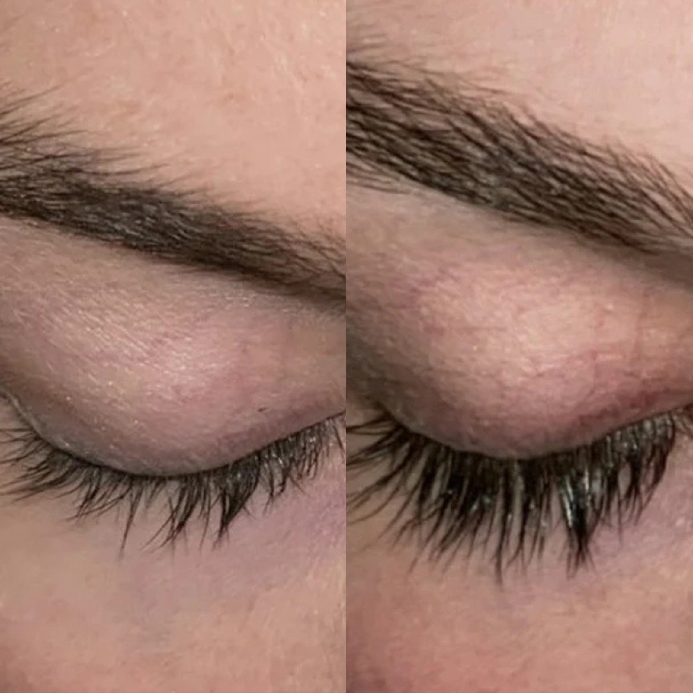 Xlash Eyelash Serum - сыворотка для ресниц, 3мл