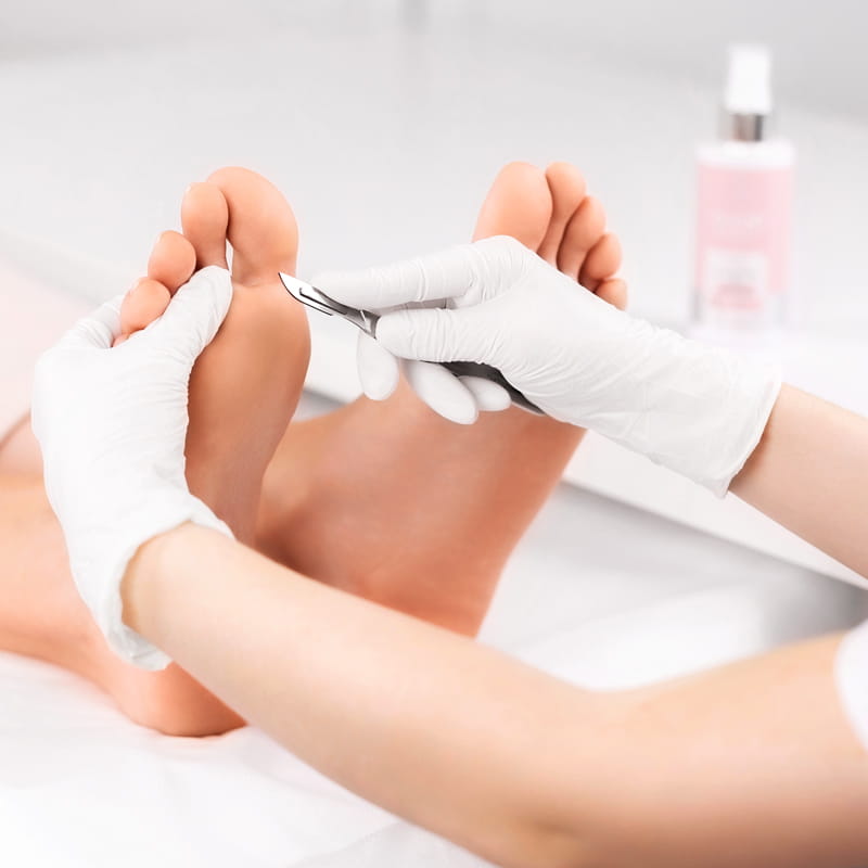 PHARM FOOT Ādas un tulznu mīkstinātājs, OSMO TONIC 150ml