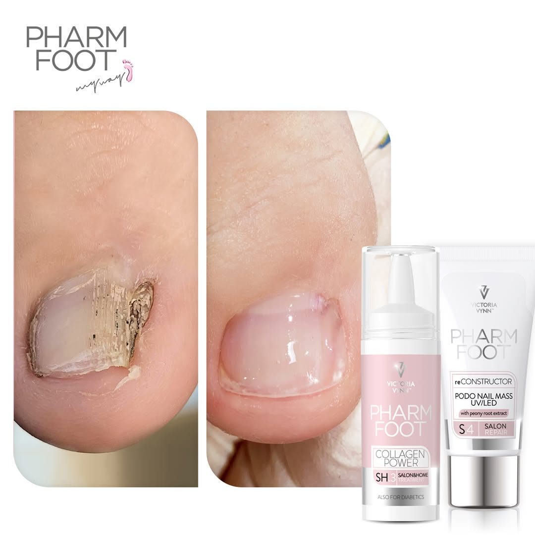 PHARM FOOT Реконструктор ногтей,  reConstructor Podo Nail Set UV/LED