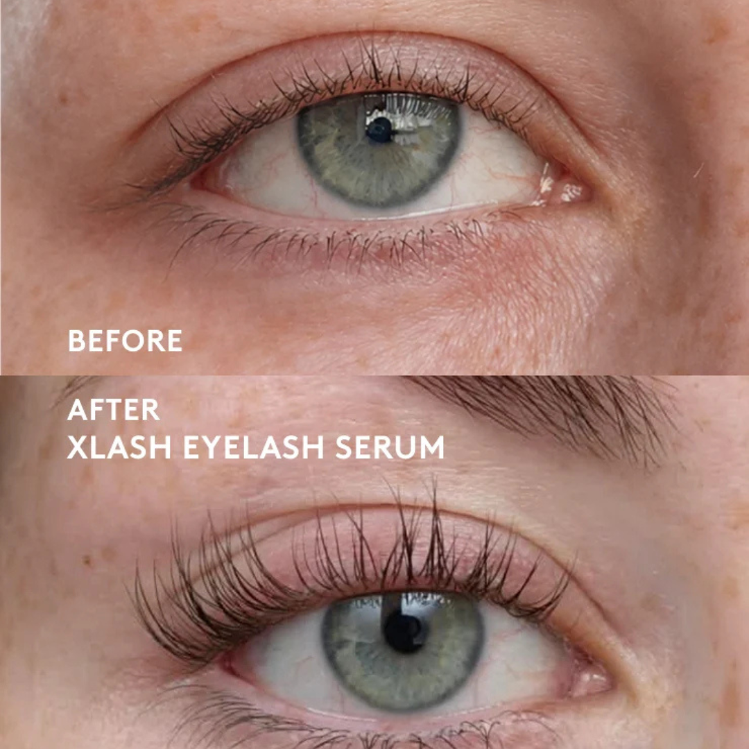 XLASH Eyelash Serum - eyelash serum, 3 ml